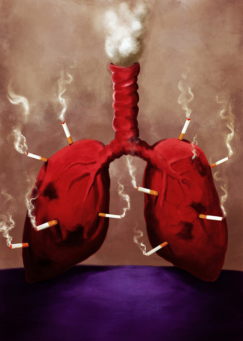 Illustration of cigarettes stuck on lungs