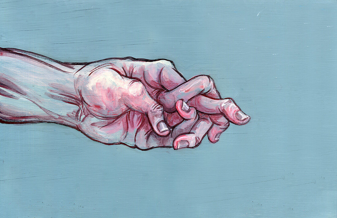 Illustration of man's hand with jumbled fingers