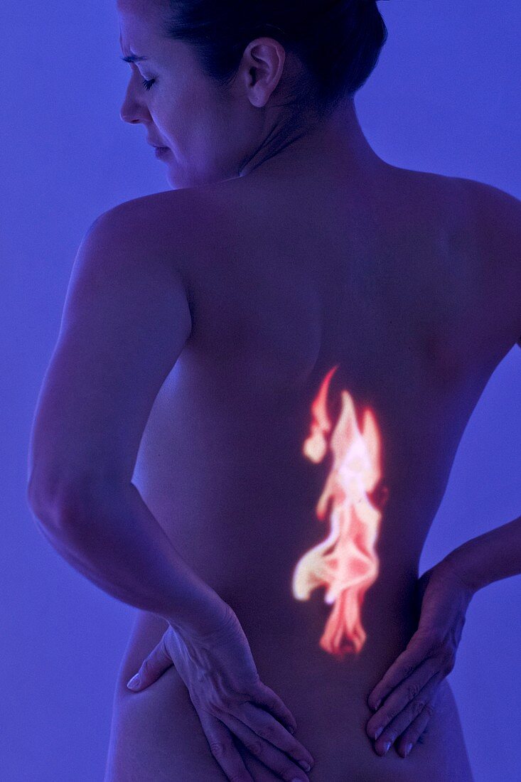 Woman with back pain, conceptual image