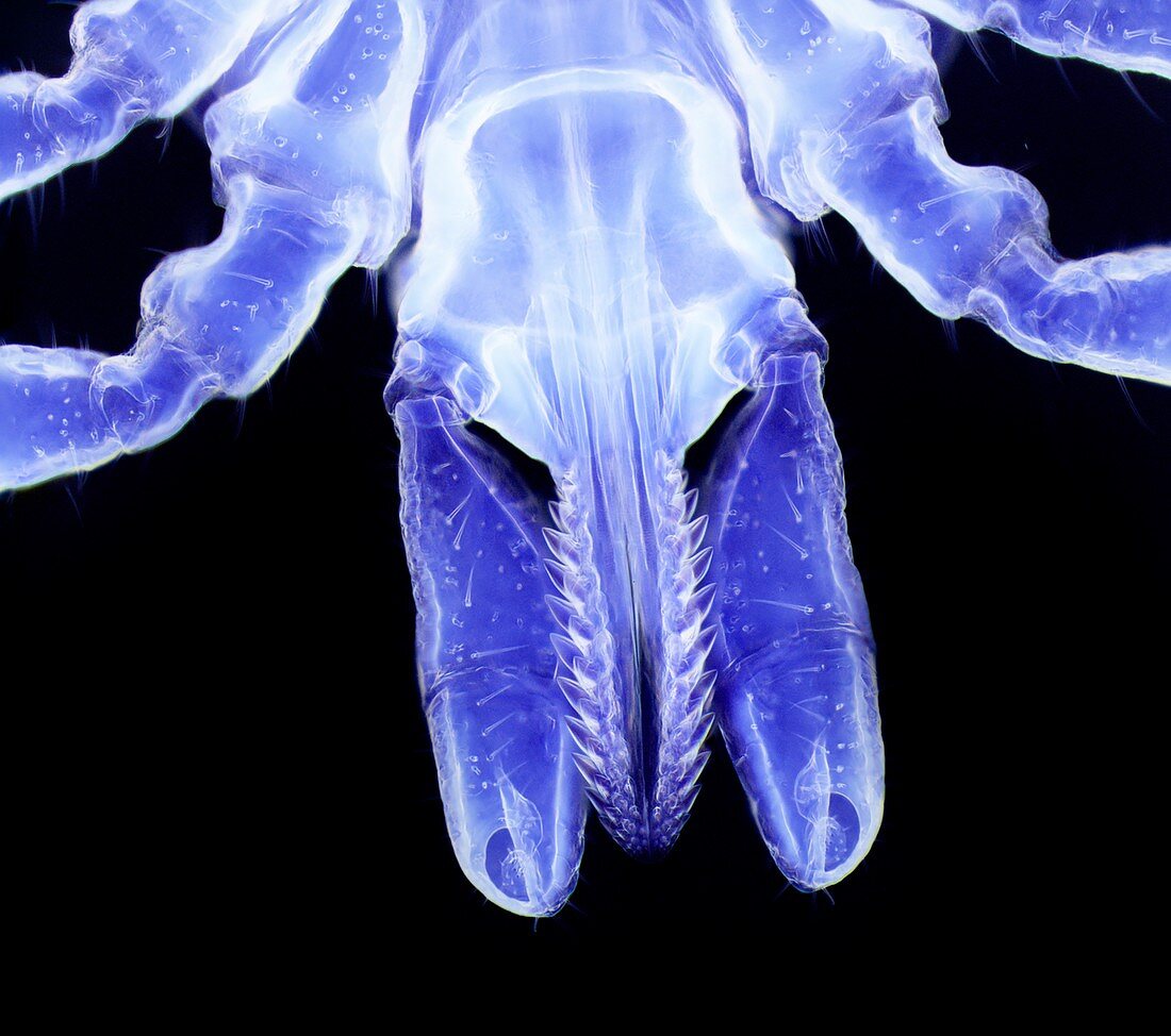 Lyme disease tick mouthparts, light micrograph