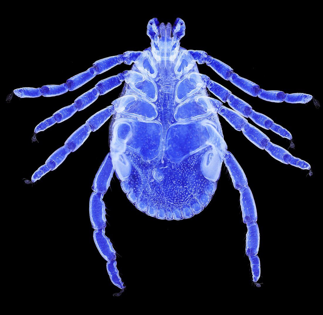 American dog tick, light micrograph