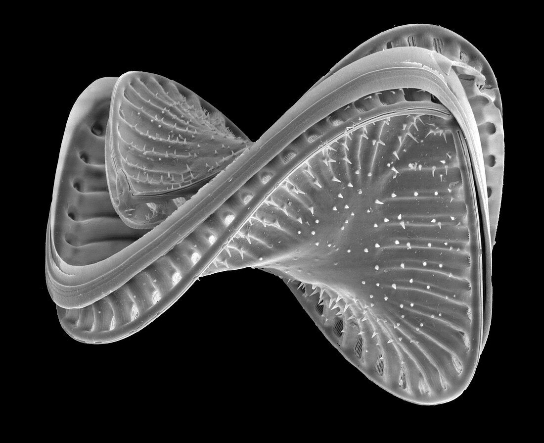 Campylodiscus diatom, SEM