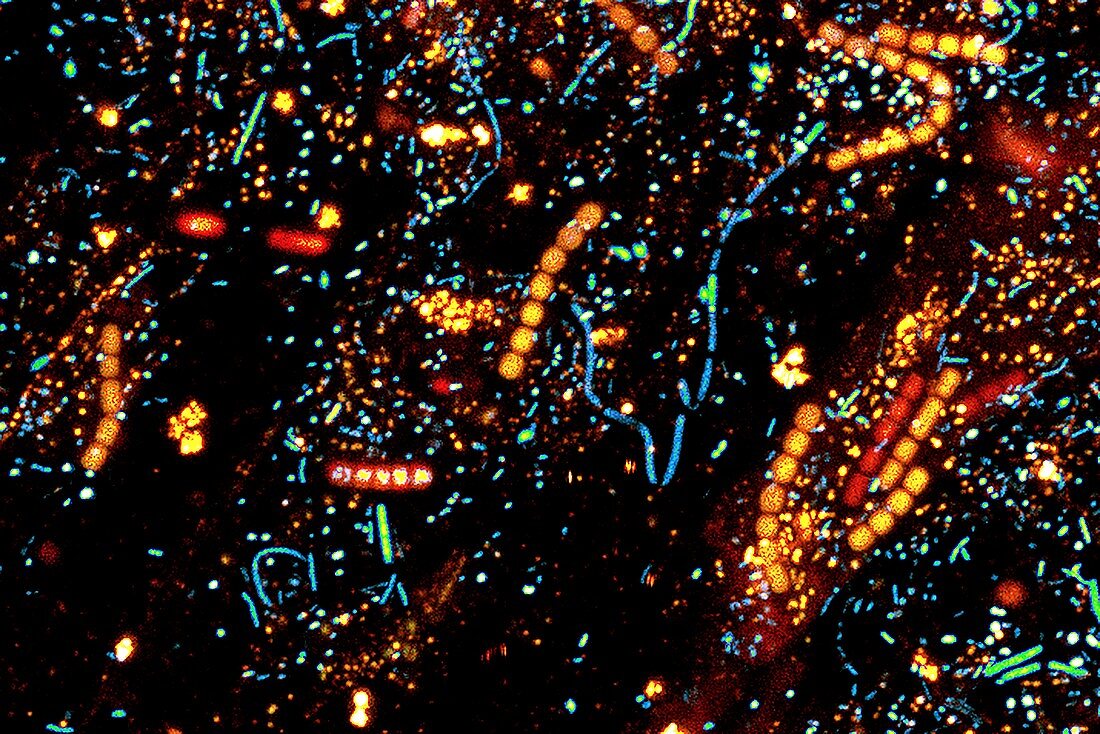 Bacteria degrading plant matter, confocal micrograph