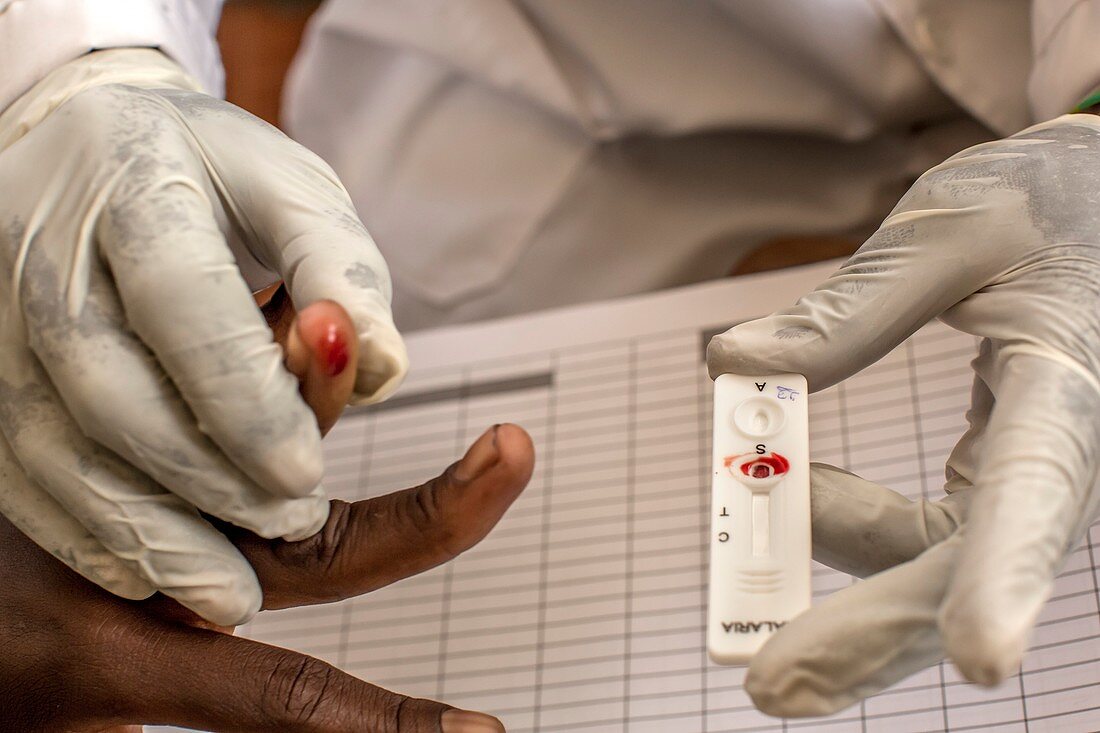 Malaria rapid diagnostic test