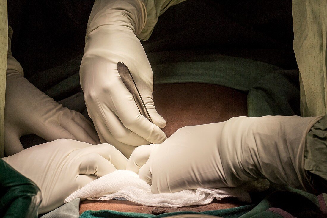 Surgeons making an incision