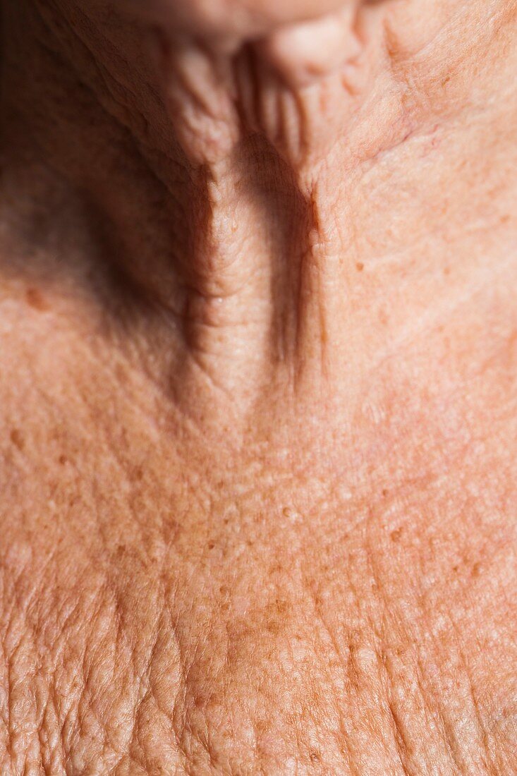 Elderly woman's neck and upper chest