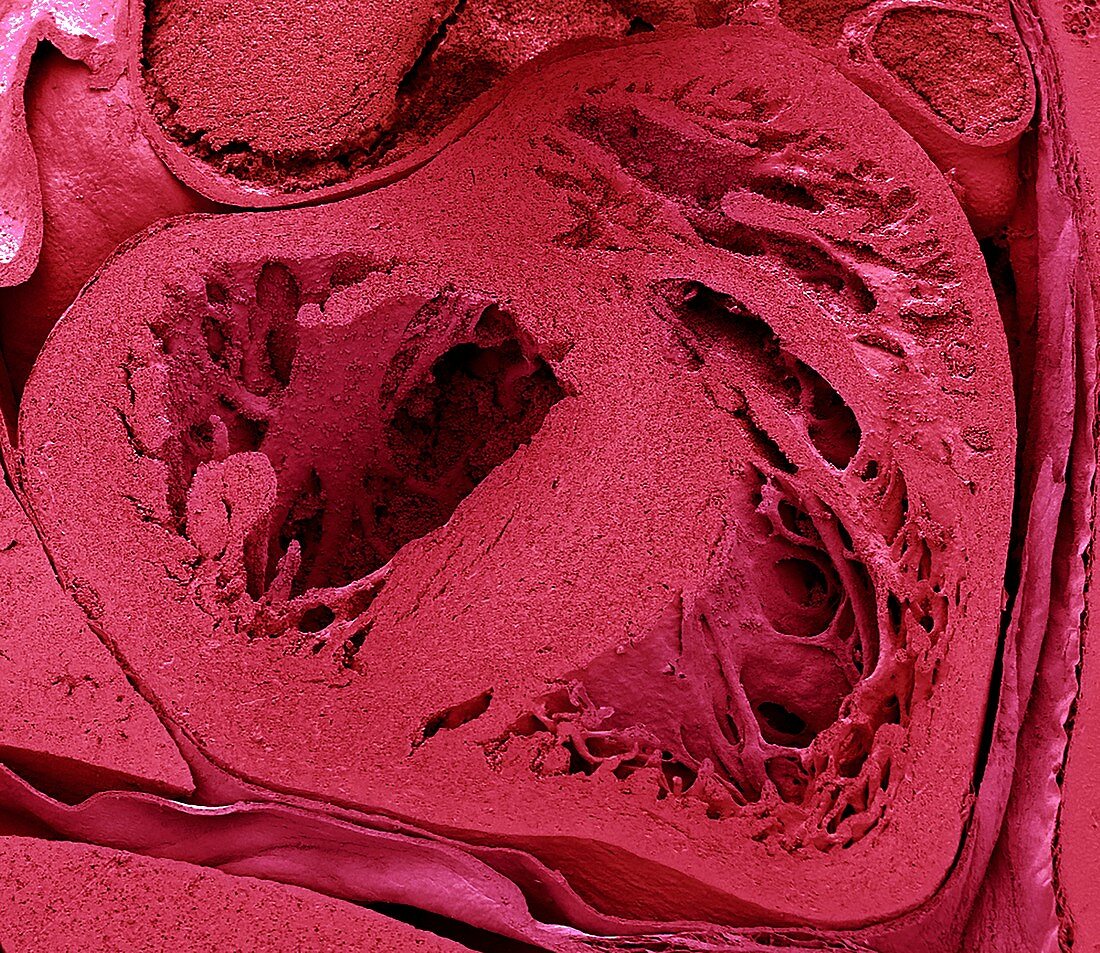Mouse embryo heart, SEM