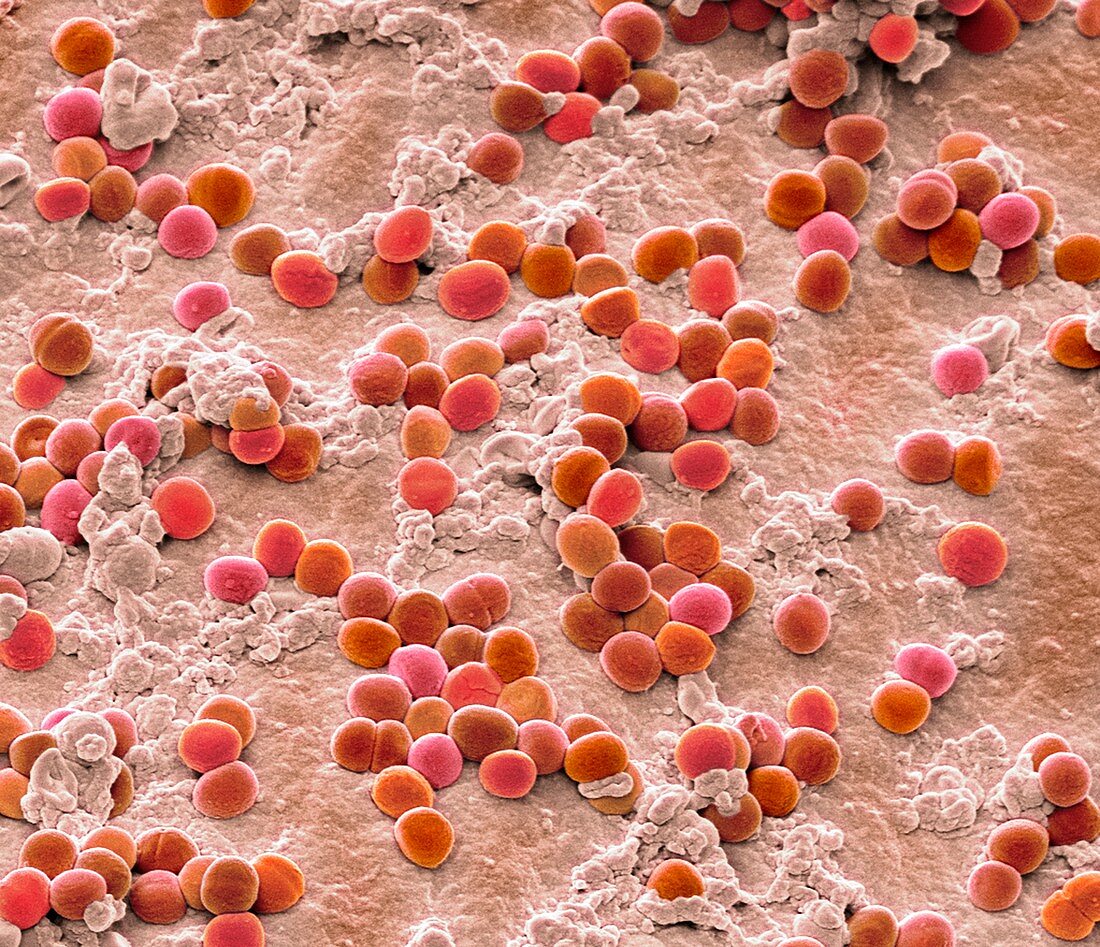 Staphylococcus bacteria, SEM