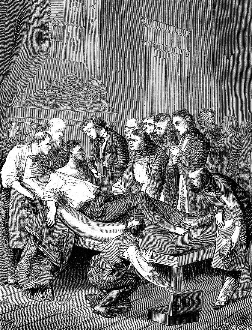 William Morton using ether anaesthesia, 19th C illustration