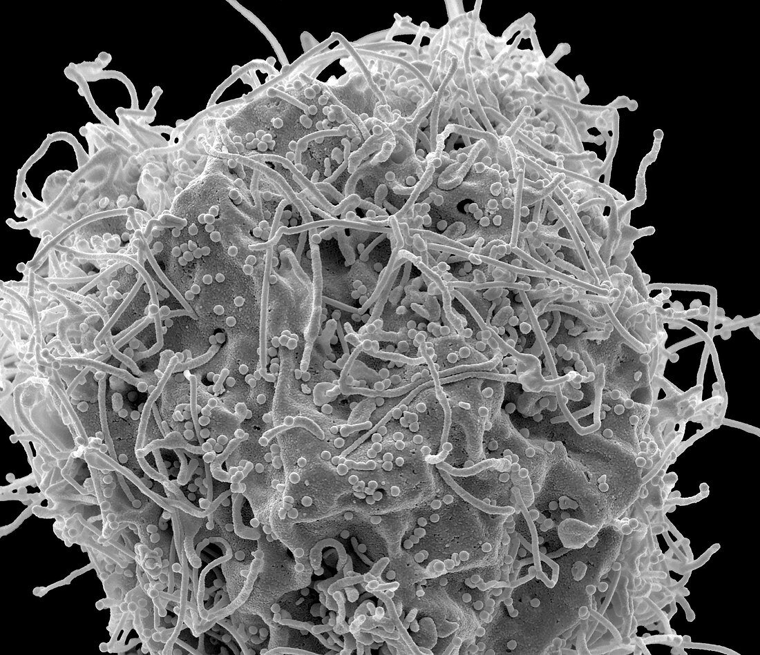 HIV infected 293T cell, SEM