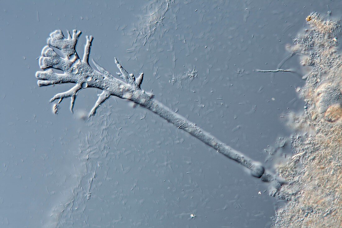 Amoeba from shower drain, light micrograph