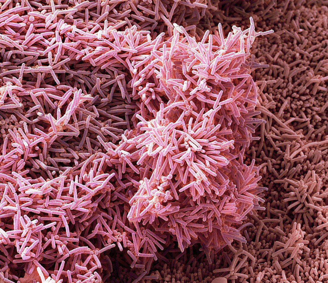 Plaque-forming bacteria, SEM