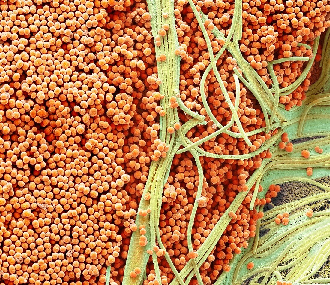 Bacteria from a train door handle, SEM