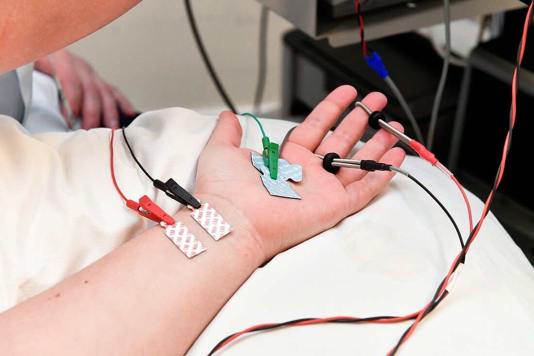 Nerve conduction test on wrist patient