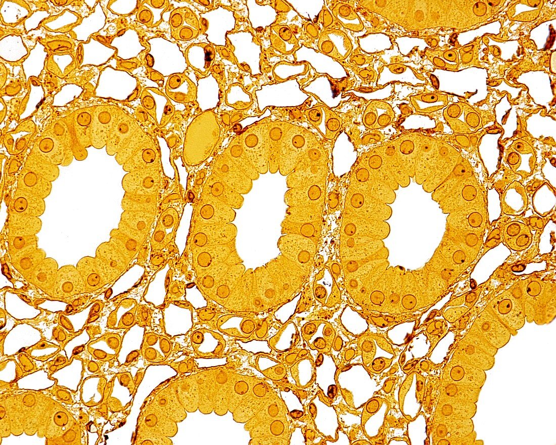 Kidney medulla, light micrograph