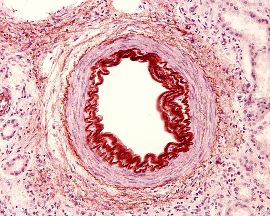 Renal muscular artery, light micrograph