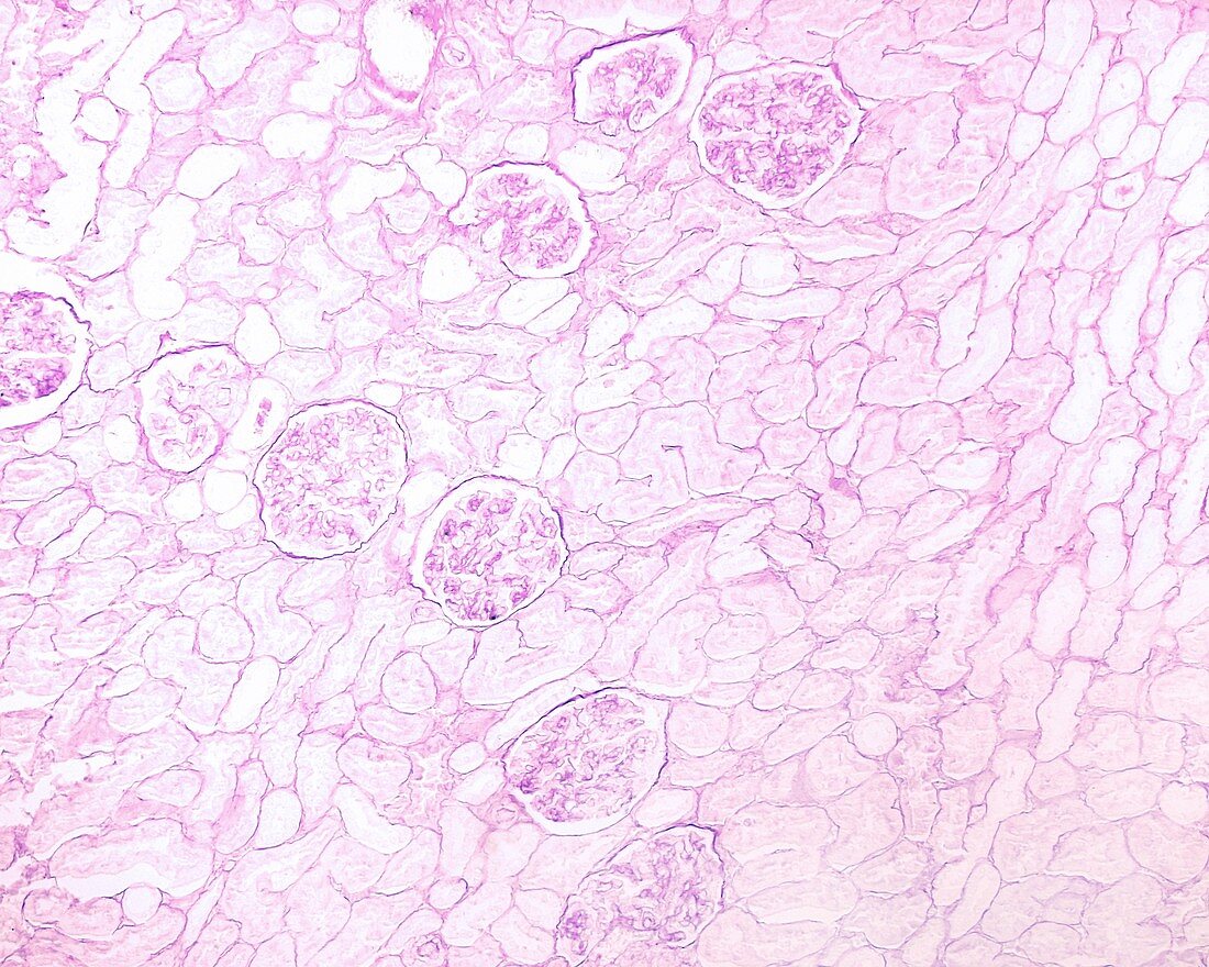 Kidney basement membranes, light micrograph