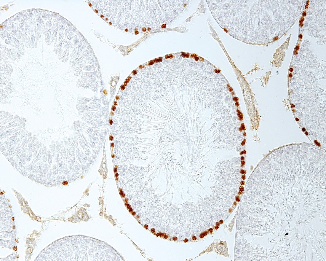 Seminiferous tubules, light micrograph