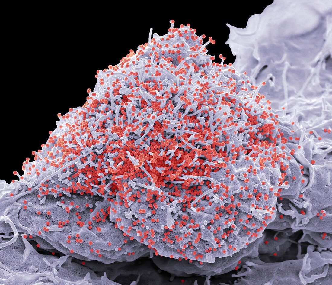 HIV infected cell, SEM
