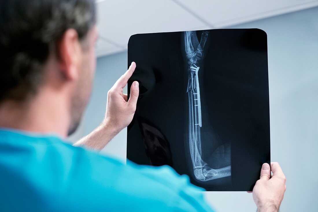 Doctor looking at x-ray of arm