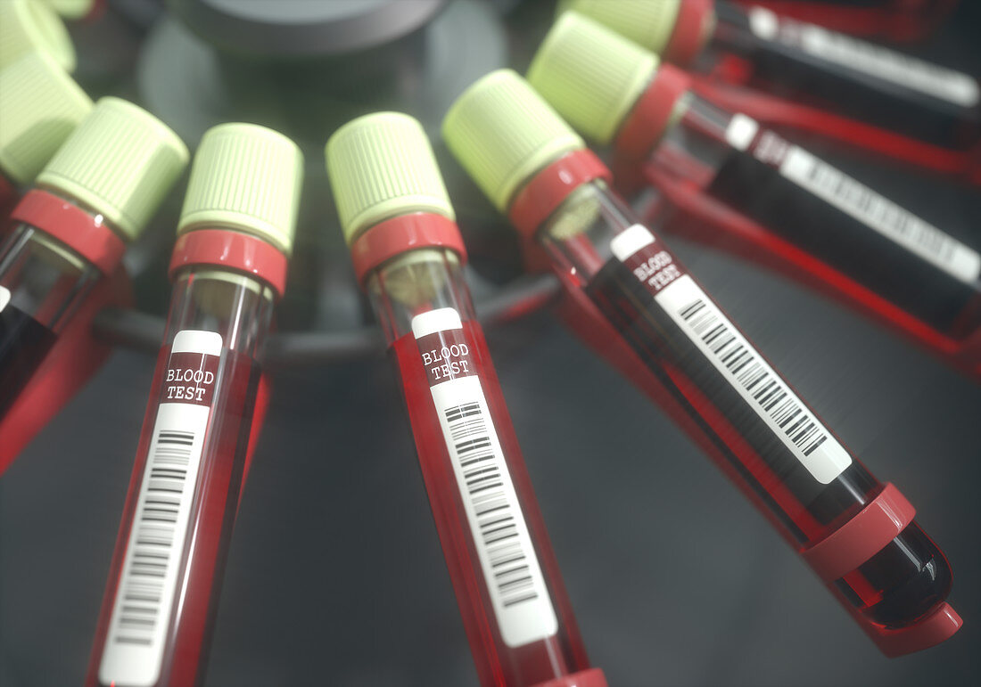 Blood samples in centrifuge, illustration