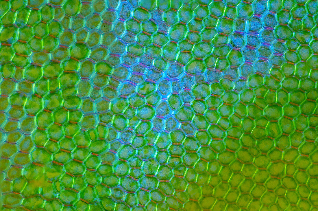 Liverwort leaf, light micrograph