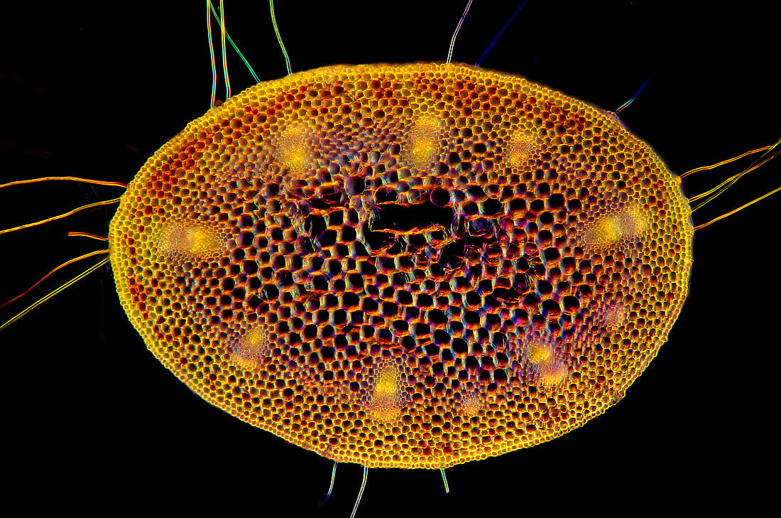 Liverleaf (Hepatica sp.) stem, light micrograph