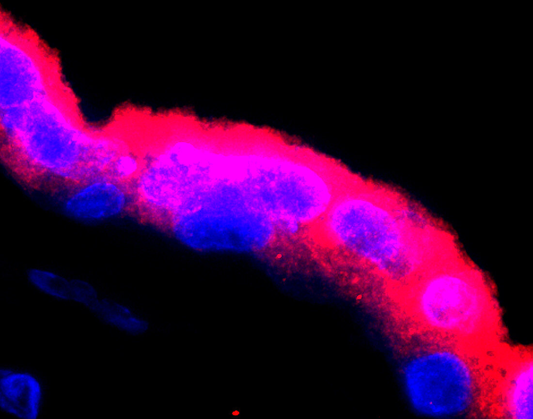 Trophoblasts, fluorescence micrograph