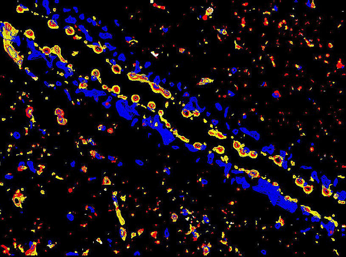 Brain blood vessel, fluorescence light micrograph