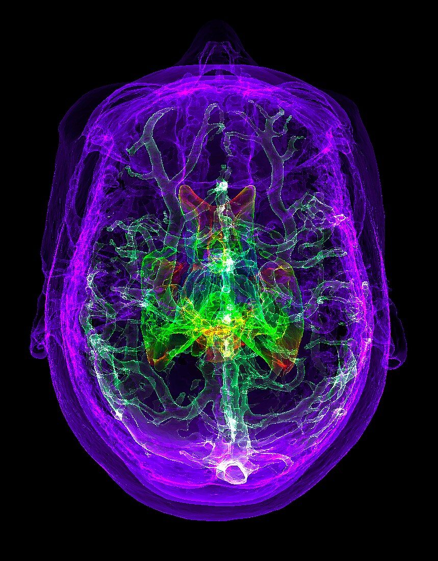 Human skull and brain, 3D MRI scan