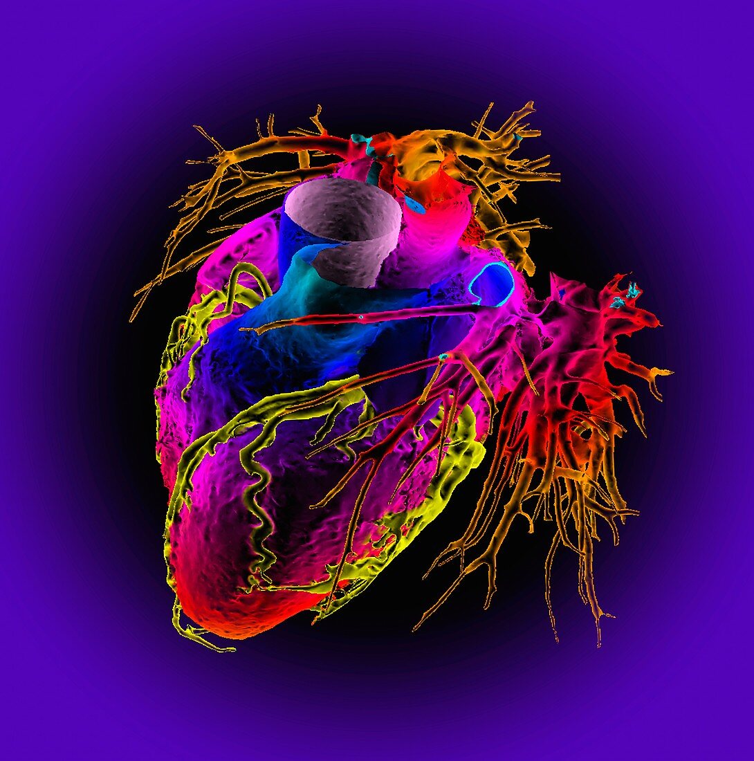 Human heart, 3D CT angiogram