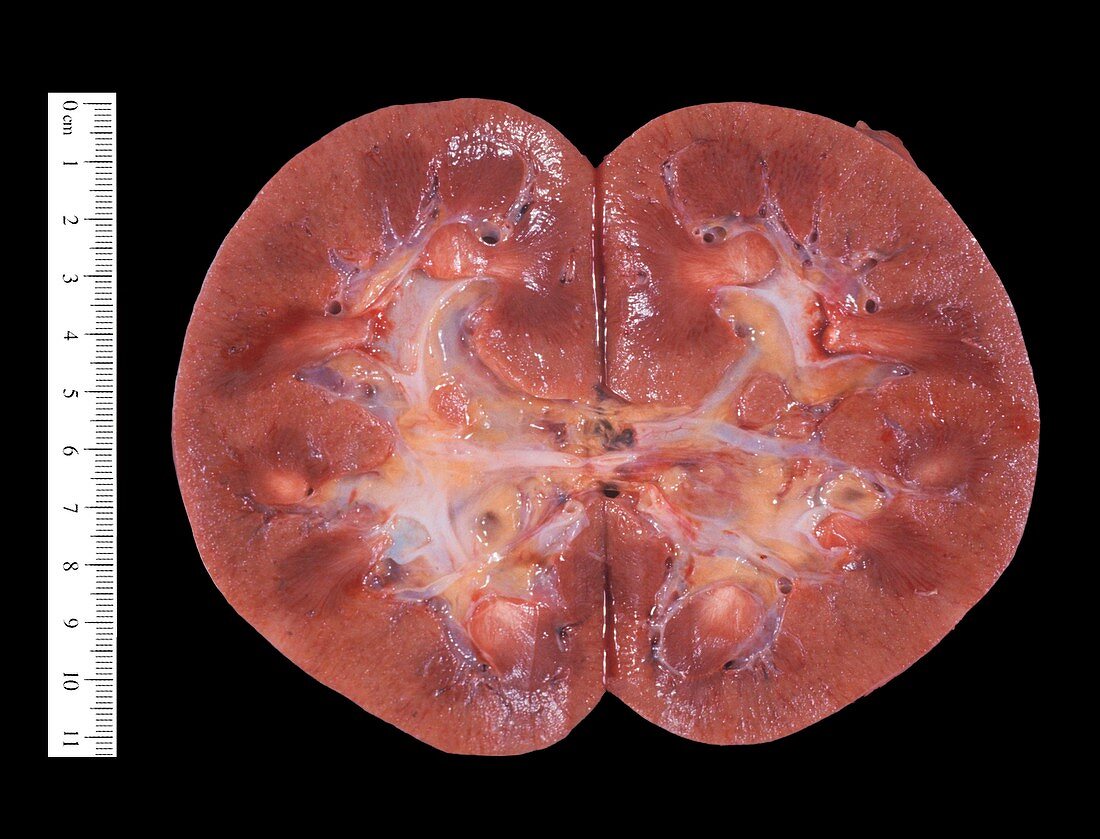 Macro section of a normal human kidney