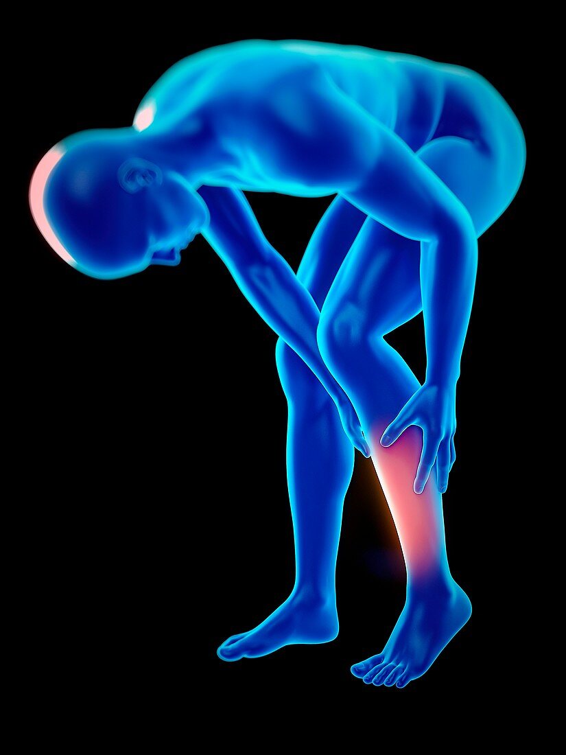 Person with leg ache, illustration