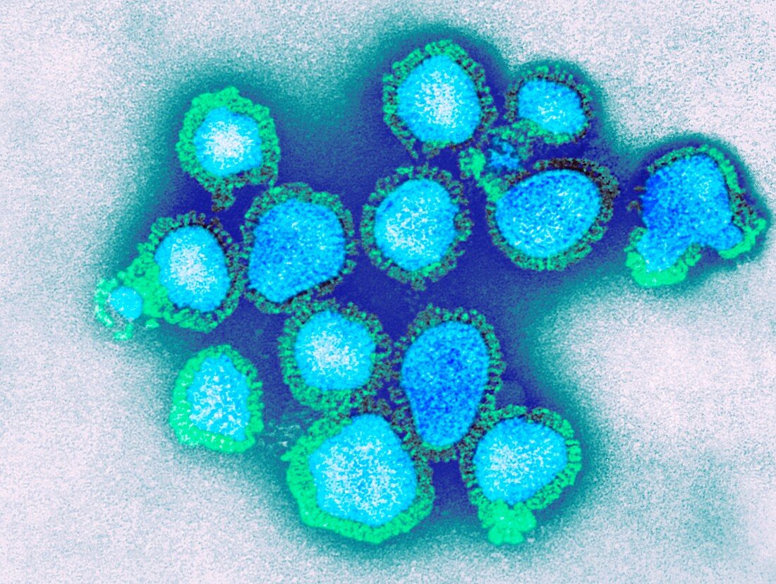 H3N2 influenza virus particles, TEM