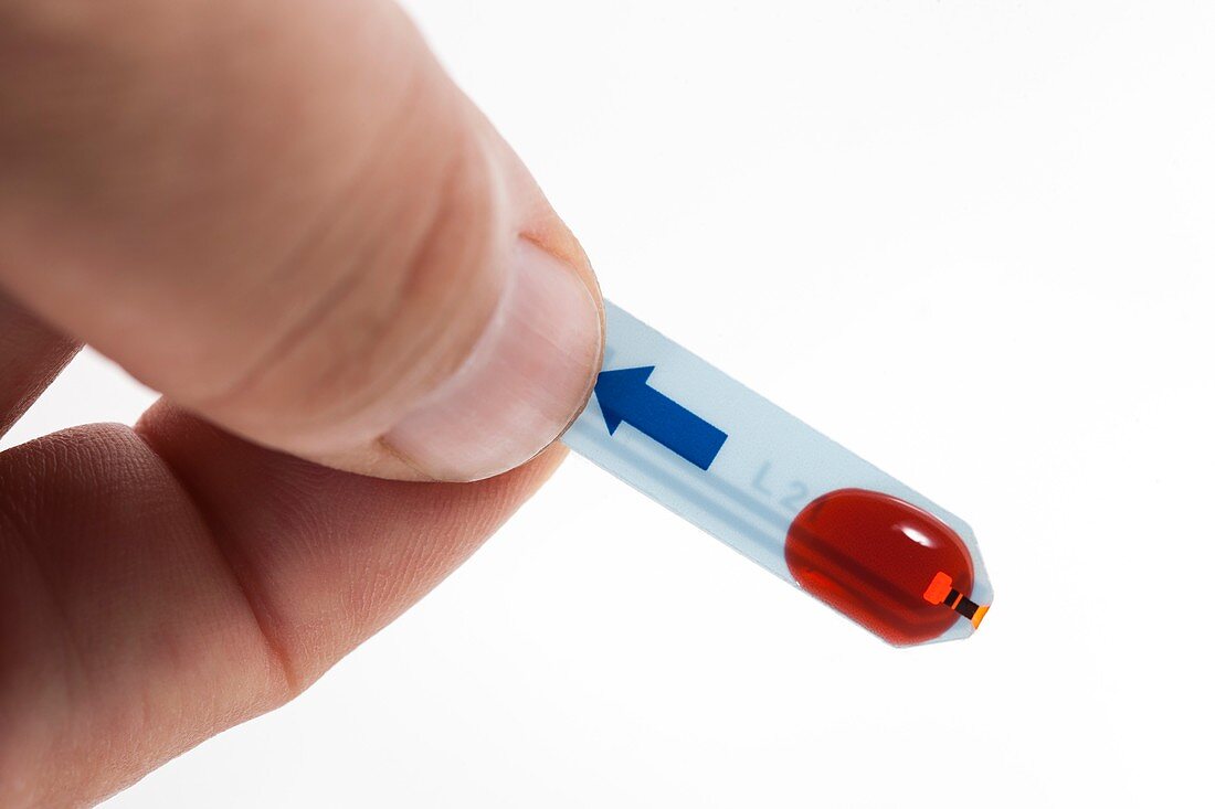 Blood sample on glucose test strip