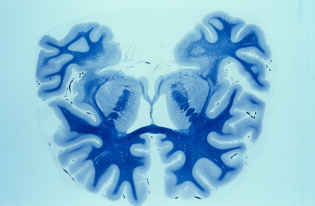 Brain myelin, light micrograph