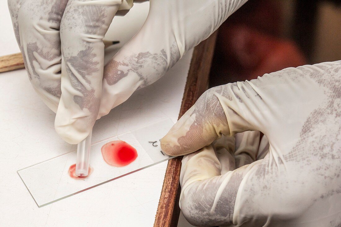 Preparing a blood sample