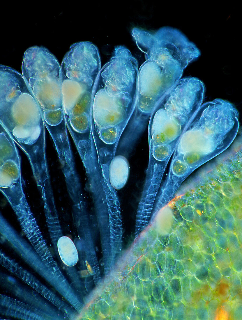 Colonial rotifers, light micrograph