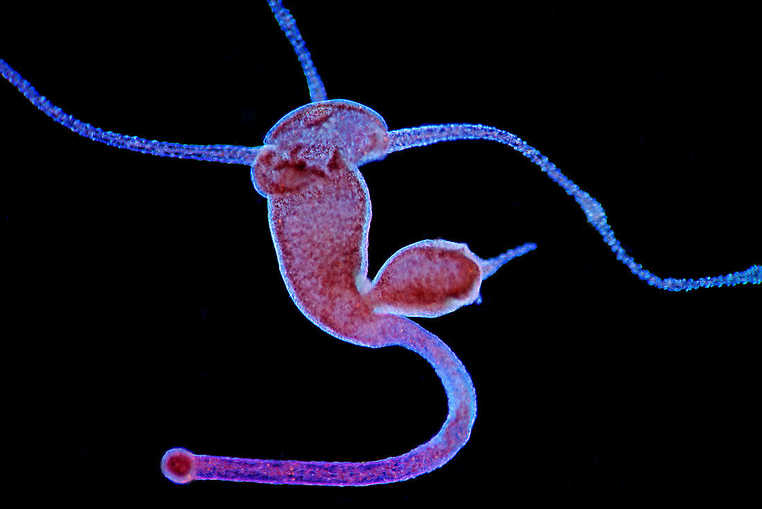 Hydra budding, light micrograph