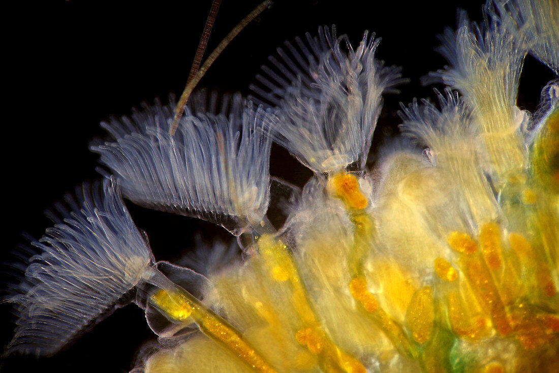 Bryozoan colony, light micrograph