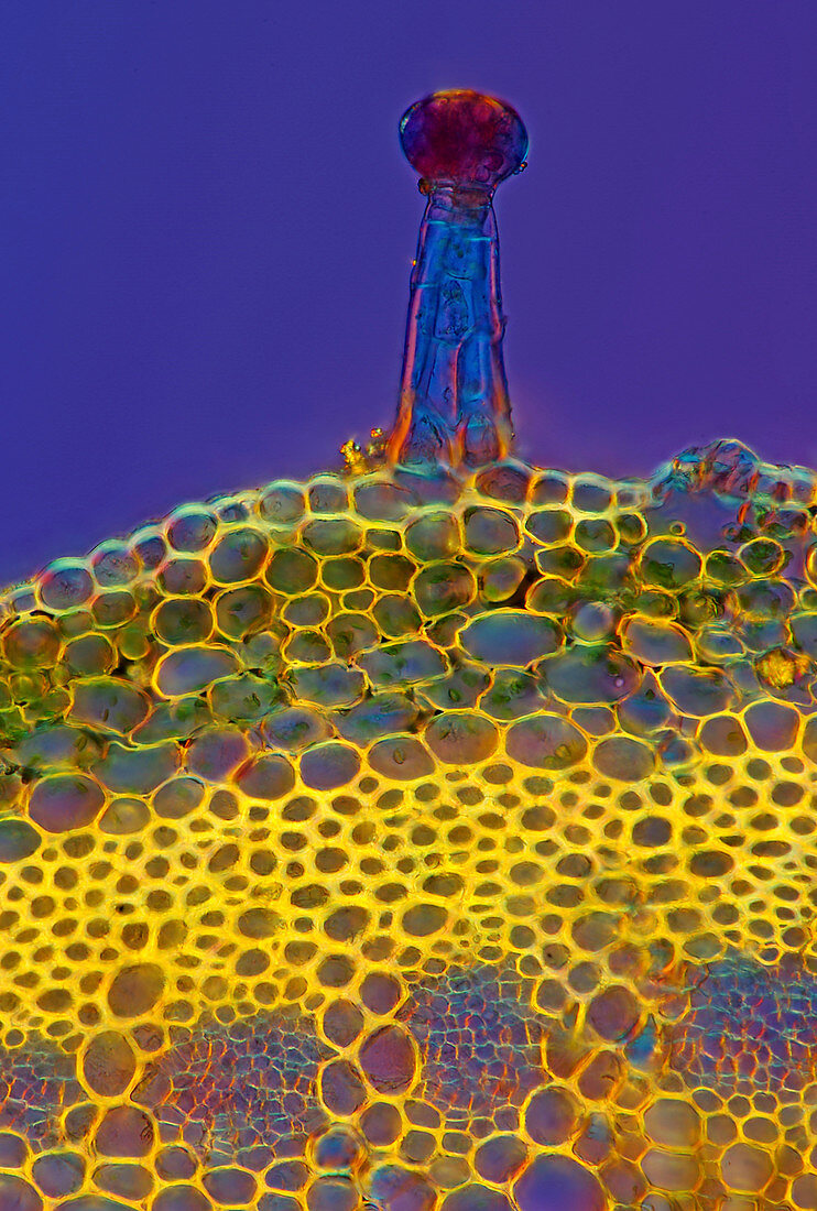 Heuchera plant trichome, light micrograph