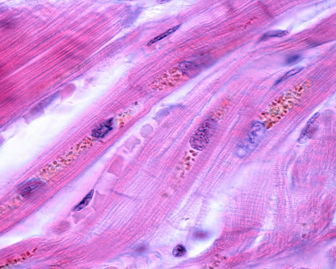 Cardiac myocytes, light micrograph