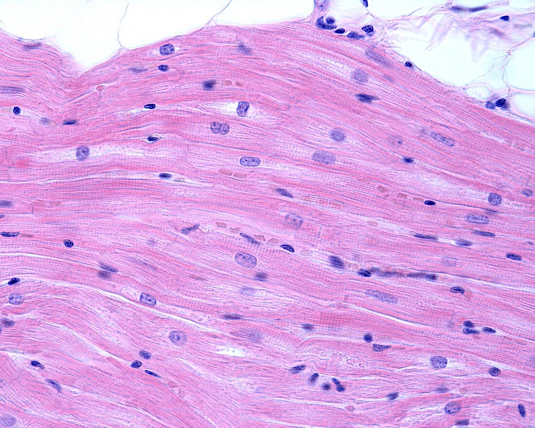 Cross sectioned heart muscle fibres, LM