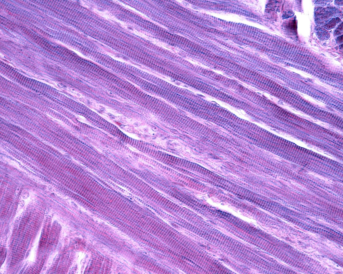Striated skeletal muscle fibres, LM