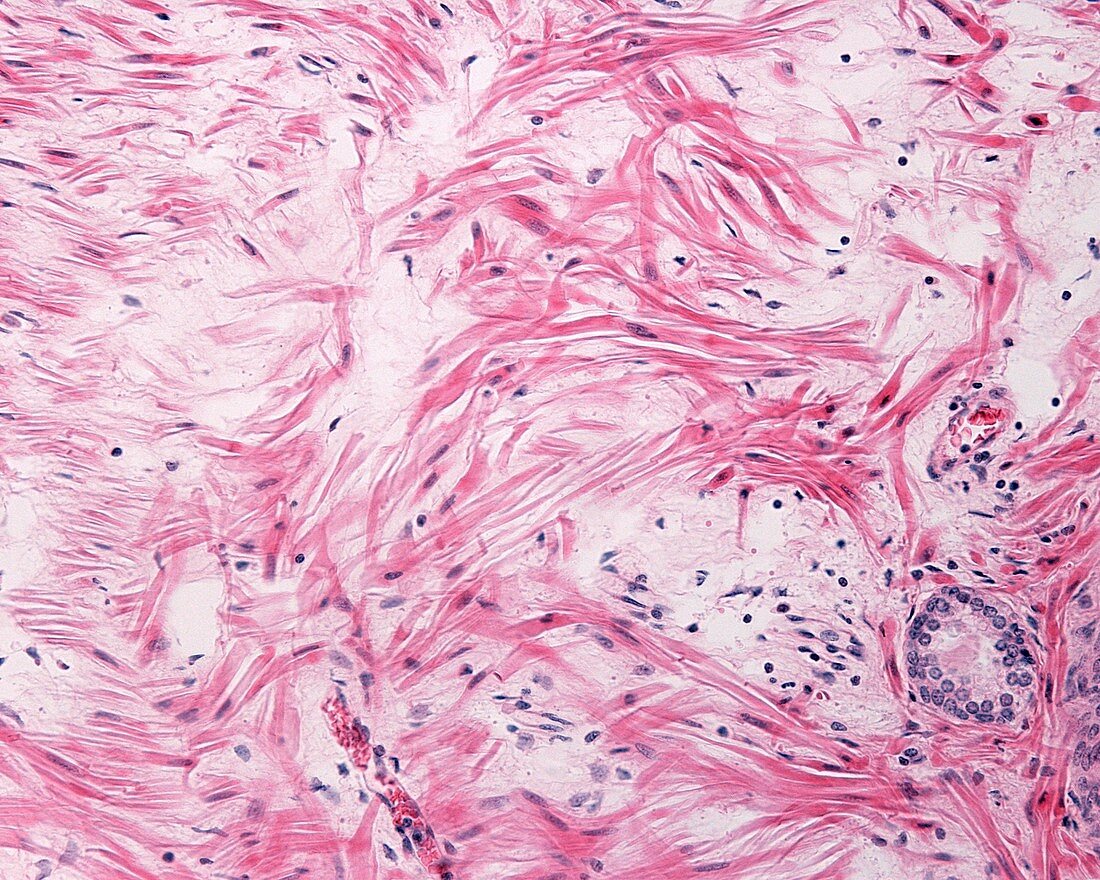 Prostate smooth muscle fibres, LM