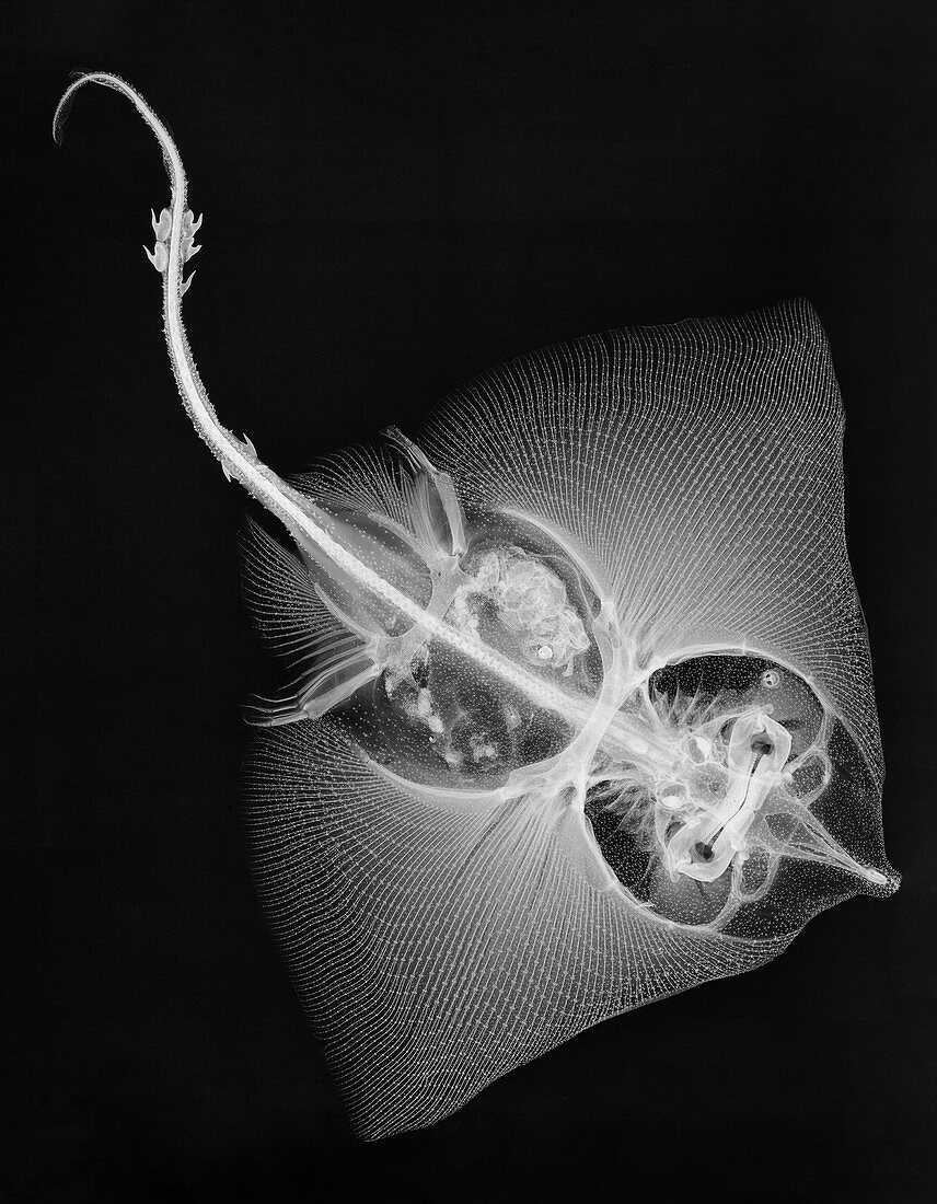 Thornback ray, X-ray
