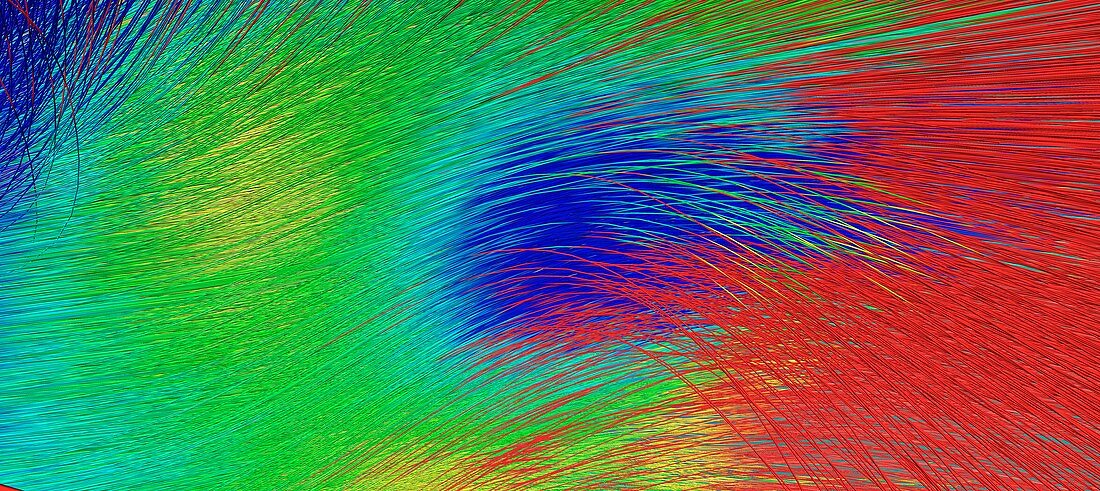 White matter fibres, DTI scan