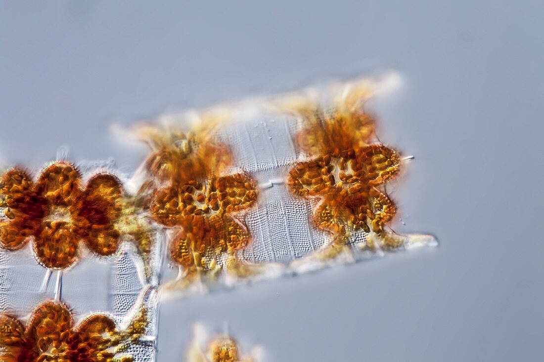 Odontella sp. diatom, light micrograph