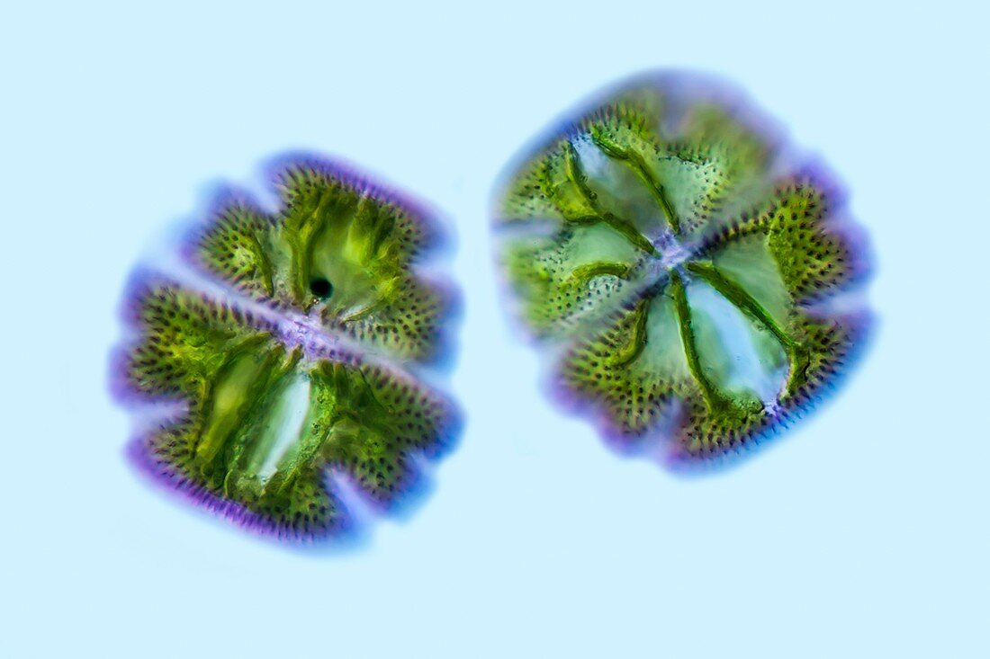 Micrasterias truncata desmids, light micrograph