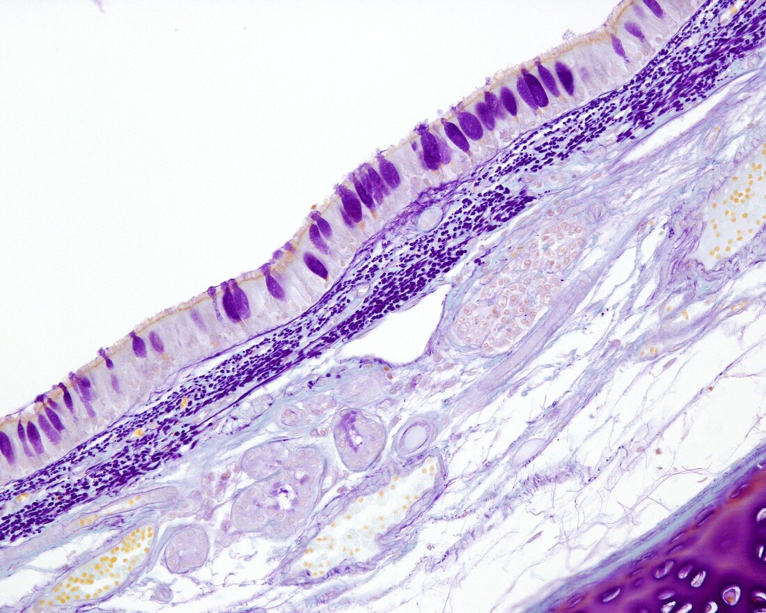 Layers of trachea wall, light micrograph